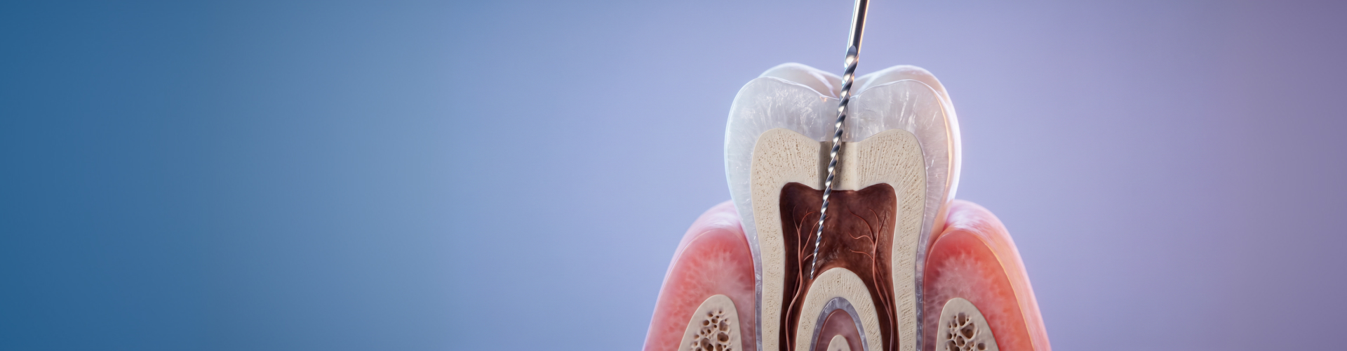 Tooth model showing internal anatomy.